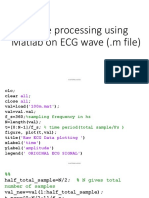 Image Processing of ECG Wave Using Matlab