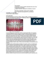 Tratamiento para El Cubrimiento Radicular