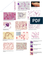 Hematology Slides Step 1 Usmle