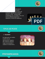 Tipos de Postes