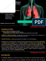 Derrame Pleural