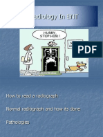 Radiology in ENT