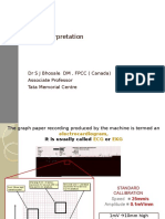 ECG Interpretation: DR S J Bhosale DM, FPCC (Canada) Associate Professor Tata Memorial Centre