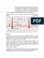 Electrocardiograma II PDF