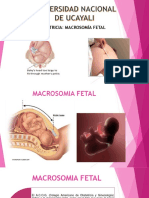 Macrosomía Fetal