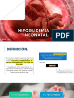 Hipoglicemia Neonatal Expo