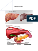Higado Graso