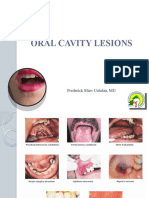 Oral Cavity Lesions