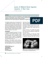 Bilateral Renal Agenesis