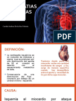 Cardiopatia Isquemica