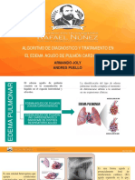 Edema Pulmonar.