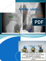 Artritis Septica