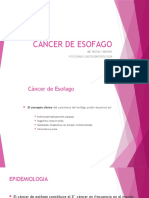 Cancer de Esofago