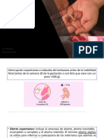 Tipos de Aborto