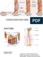 Consolidación Ósea: Lizbeth Gpe. Casillas Plascencia. Ortopedia