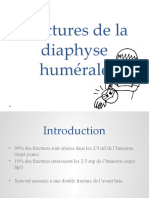 Fractures de La Diaphyse Humérale