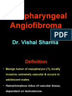 Nasopharyngeal Angiofibroma