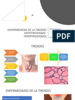 Enfermedades de La Tiroides