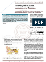 Implementation of Digital Hearing AID For Sensory Neural Impairment