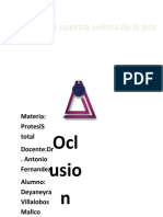 Oclusion Trabajo