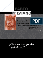 Parto Pelviano