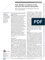 Morphologic Alterations On Posterior Iris-Claw Intraocular Lenses After Traumatic Disenclavation