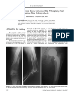 J Orthop Trauma 2007 21 (5) 352