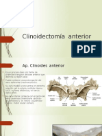 Clinoidectomia