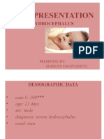 Case Presentation: Hydrocephalus