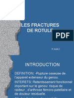 Fractures de Rotule