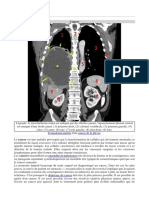 Cancer Définition Et Terminologie Et Étymologie