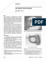 A Modification of The Altered Cast Technique PDF