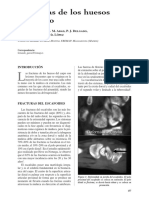 Fracturas de Los Huesos Del Carpo: F. García de Lucas, J. M. Abad, P. J. Delgado, A. Fuentes, J. I. García López