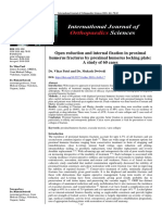 Open Reduction and Internal Fixation in Proximal Humerus Fractures by Proximal Humerus Locking Plate: A Study of 60 Cases