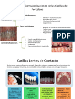 Indicaciones y Contraindicaciones de Las Carillas de Porcelana