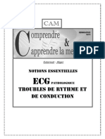 ECG Pour Les Debutants Troubles Du Rythm PDF