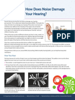 How Does Noise Damage Your Hearing?