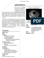 Corneal Transplantation