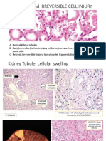 Reversible and Irreversible Cell Injury