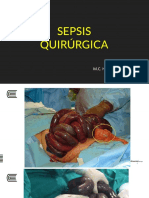 Sepsis Quirurgica