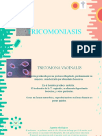 Tricomoniasis