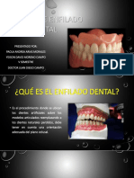 Enfilado Dental