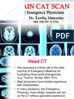 Brain CT Scan