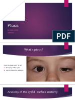 Ptosis 161217144417 PDF