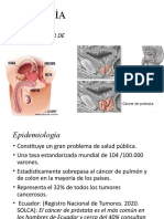 Cáncer de Próstata