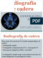 Radiografía de Cadera