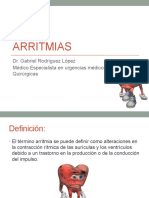 Arritmias