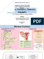 Miomas Uterinos y Tumores Anexiales