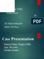 Bilateral TMJ Ankylosis New