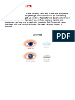 Biology - The Eye (Cateracts)